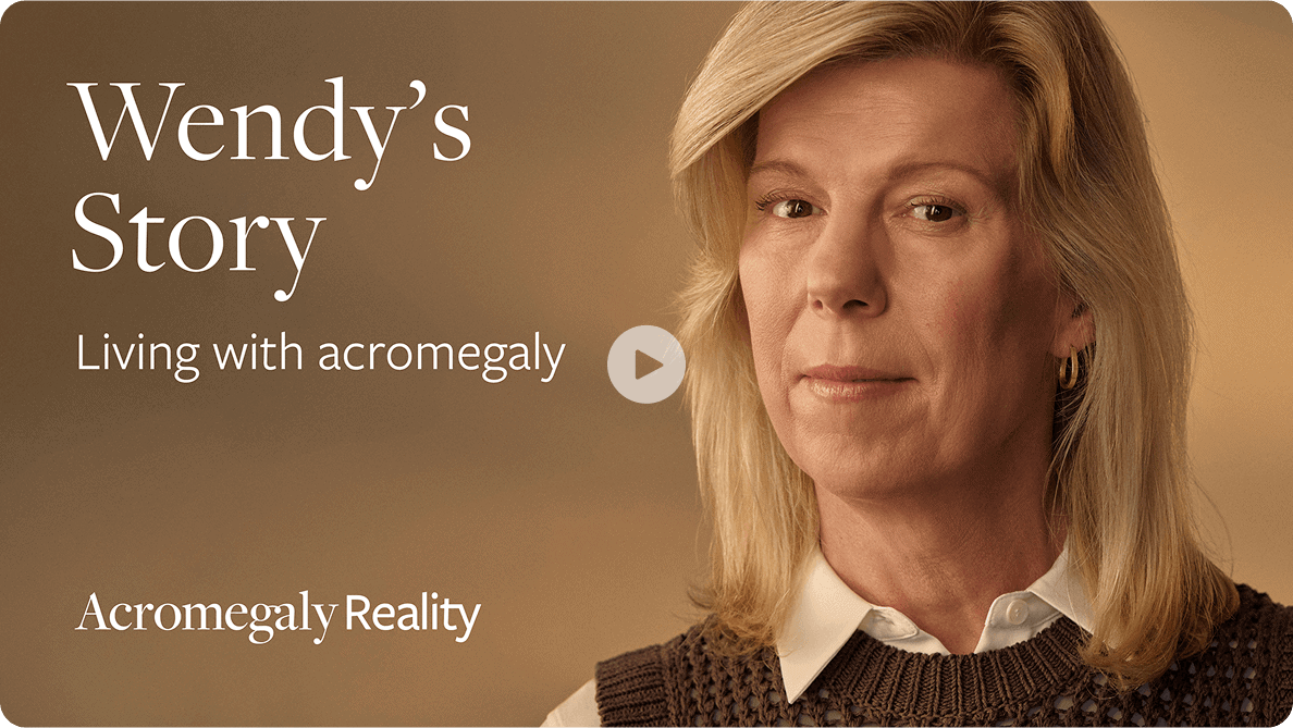 Wendy, living with acromegaly.